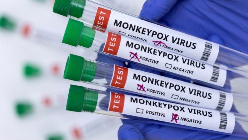 Viruela del mono: OMS informa de 780 casos en 27 países y reitera que riesgo es 'moderado'