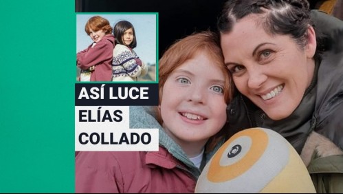 A sus 14 años se sometió a una compleja operación: Así luce hoy Elías Collado, el recordado 'Andy' de Isla Paraíso