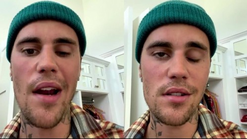 'Mi enfermedad está empeorando': Justin Bieber sufre parálisis facial producto de un extraño síndrome
