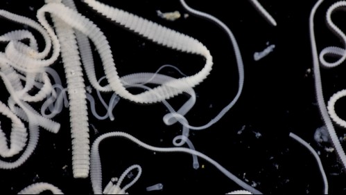 Es un parásito: Estos 4 síntomas indican que tienes la lombriz solitaria