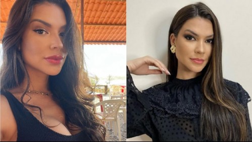 Muere reina de belleza brasileña: En una operación de rutina le dio una hemorragia cerebral y un paro cardíaco