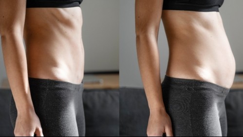 Así es cómo se siente un 'ataque al colon'