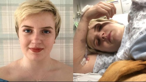 'Soy alérgica a las emociones fuertes': Joven sufre extraño síndrome que le afecta fuertemente al reírse o llorar