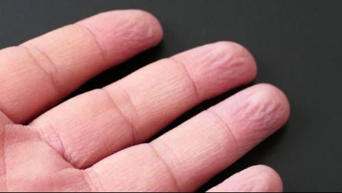 ¿Por qué se arrugan los dedos en el agua? Esta es la explicación que dan los expertos