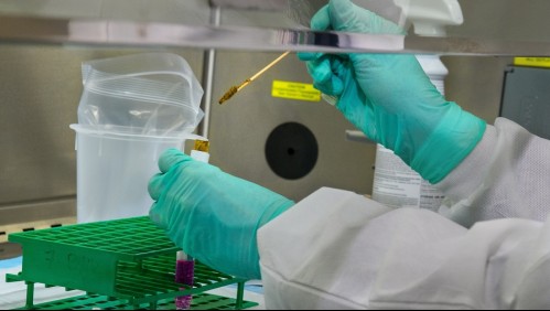 Virus de Marburgo: Estos son los síntomas de la enfermedad infecciosa por la que habrían fallecido dos personas en Ghana