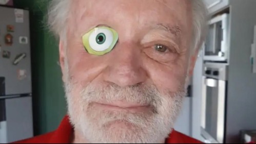 Hombre al que le falta un ojo debió pegarse el de una caricatura para que una aplicación lo reconociera