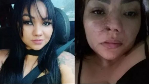 Se operó la nariz, quedó irreconocible y al final se enteró que el doctor era un dentista: 'Lloro todos los días'