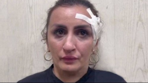 Vendió a su bebé recién nacido para operarse la nariz y terminó detenida por 'trata de personas'