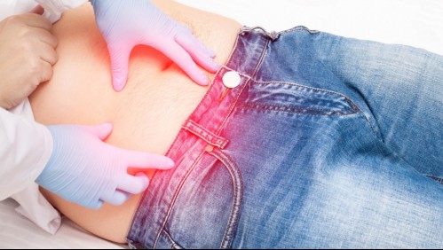 Podría ser mortal: Estas son las señales que te ayudarán a reconocer si sufres una peritonitis