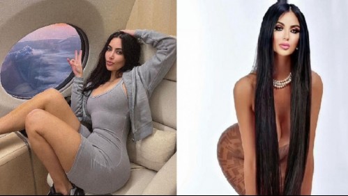 'Era una adicción': Gastó 600 mil dólares en 40 cirugías para parecerse a Kim Kardashian y ahora paga para revertirlas