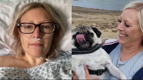 Fue al doctor por un 'dolor persistente' en la pierna mientras paseaba a su perro y recibió un severo diagnóstico