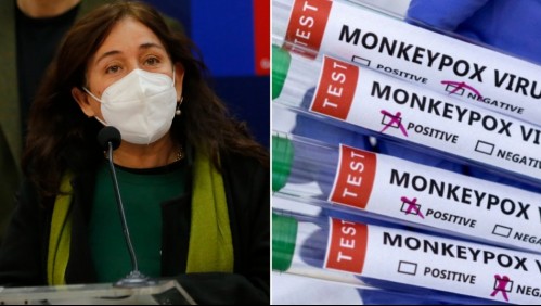 'Estamos en alerta': Minsal por decisión de la OMS de declarar la viruela del mono como emergencia internacional