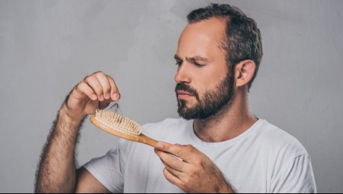 ¿Sufres de caída del cabello? Estas son algunas de las causas de la alopecia