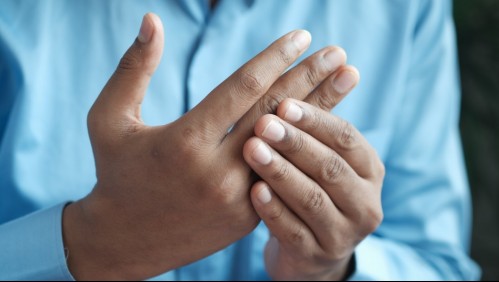 Una leve tensión puede provocar fracturas: Revisa cuáles son las manifestaciones de la osteoporosis