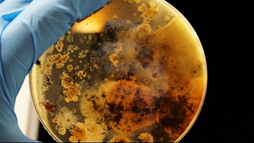 Puede causar melioidosis: Esta es la peligrosa bacteria encontrada en EEUU que puso en alerta a las autoridades