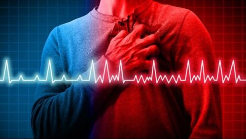 Así es cómo puedes saber si es que tienes una arritmia cardiaca