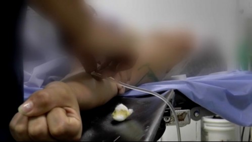 'Desfiguran y matan personas': Las graves consecuencias de las cirugías estéticas hechas por médicos sin especialización