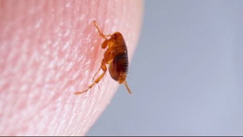 8 síntomas que te podrían advertir que te contagiaste con tifus