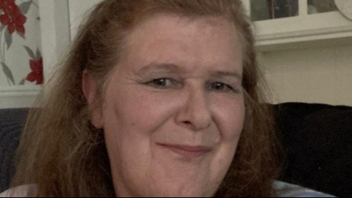 Tuvo convulsiones durante dos meses y pensó que era estrés, pero los doctores le dieron un severo diagnóstico