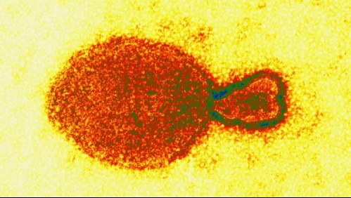 China registra 35 pacientes contagiados con nuevo y desconocido virus derivado de animales