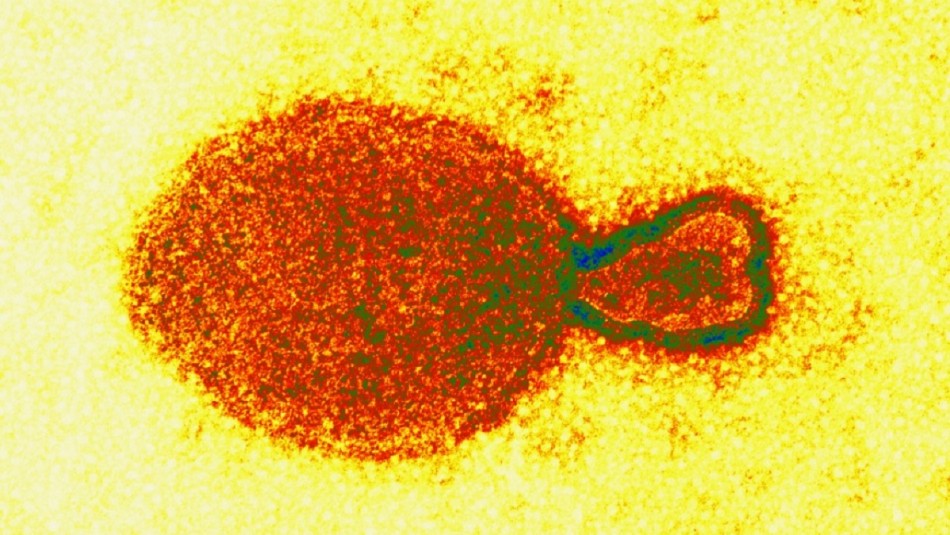 detectan-35-casos-en-humanos-de-nuevo-y-desconocido-virus China registra 35 pacientes contagiados con nuevo y desconocido virus derivado de animales