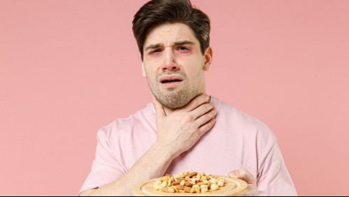 Hasta podría causar la muerte: Así es cómo puedes reconocer si sufres de una anafilaxia