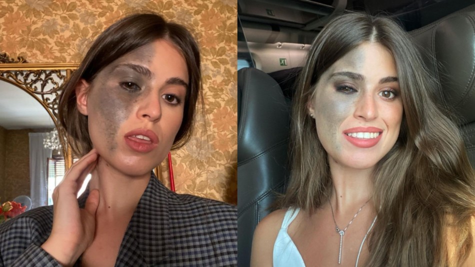 joven-modelo-nacio-con-una-extrana-mancha-que-cubrio-la-mitad-de-su-rostro Una joven modelo nació con una extraña mancha que llegó a cubrir la mitad de su rostro.