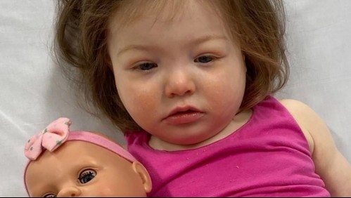 Llevaron a su pequeña hija al doctor porque su cara se hinchó 'como un globo' y recibieron una terrible noticia