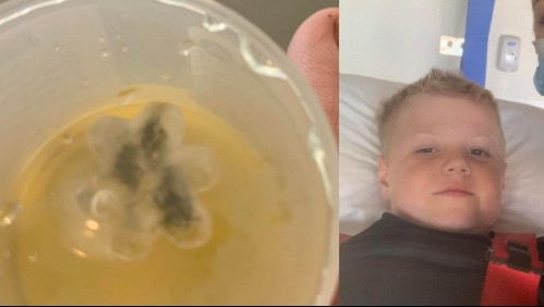 Niño tuvo tos durante cinco años y al ir al médico se dieron cuenta que tenía un juguete en su garganta