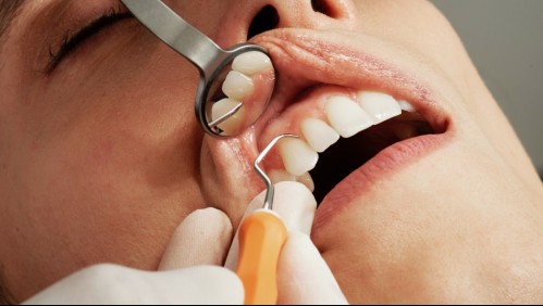 Podría detectar la diabetes: Estas son todas las enfermedades que tu dentista podría descubrir con la salud de tu boca