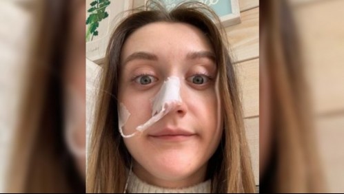 'Lo único que puedo beber es agua': Joven debe dormir sentada debido a unos dolorosos 'ataques de acidez'