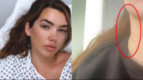 Los doctores le dieron jarabe para la tos por un 'simple virus', pero en verdad tenía una severa enfermedad