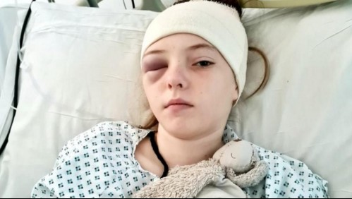 Llevó a su hija al médico por una hinchazón en los ojos y fue diagnosticada con una terrible enfermedad