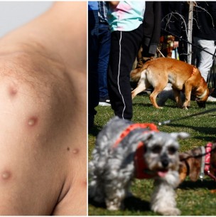 Organización Mundial de la Salud pide cautela tras transmisión de la viruela del mono de humano a perro Organización Mundial de la Salud pide cautela tras transmisión de la viruela del mono de humano a perro