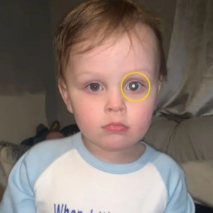 Llevó a su pequeño hijo al doctor al ver un particular cambio en su ojo y recibió una desgarradora respuesta Llevó a su pequeño hijo al doctor al ver un particular cambio en su ojo y recibió una desgarradora respuesta