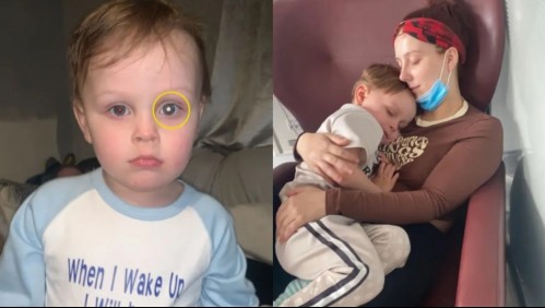 Llevó a su pequeño hijo al doctor al ver un particular cambio en su ojo y recibió una desgarradora respuesta