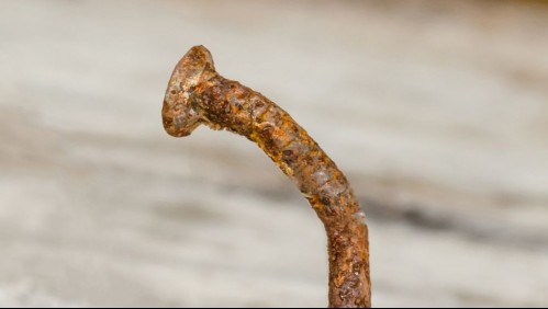 La enfermedad no tiene cura, pero sí existen formas de prevenirla: Estos son los síntomas del tétanos