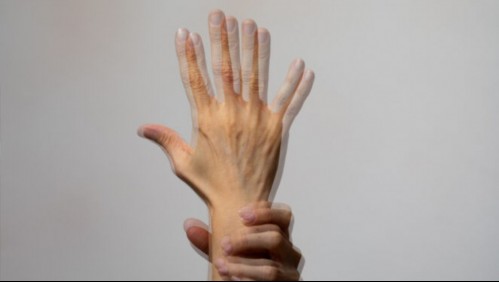 Botulismo: Estos son los síntomas de la grave enfermedad que puedes contraer por los alimentos en conserva