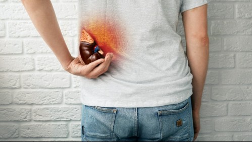 Estos son 5 síntomas que te advierten que puedes tener cálculos renales