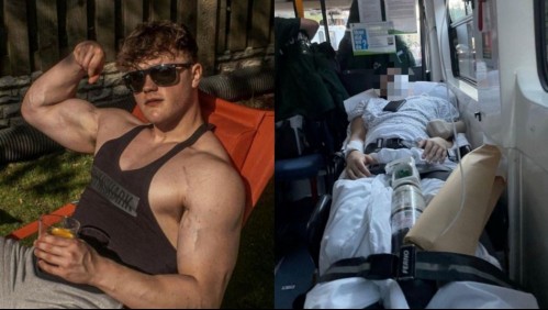 'No sabía lo que estaba pasando': Joven creyó lesionarse en el gimnasio, pero tenía una severa enfermedad