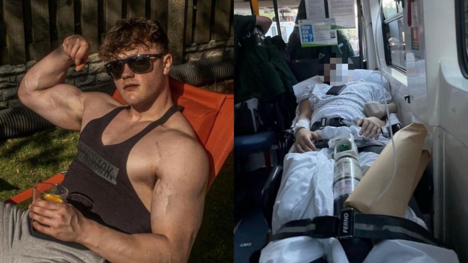 joven-creyo-lesionarse-en-el-gimnasio,-pero-en-verdad-tenia-una-grave-enfermedad Un joven creyó lesionarse en el gimnasio, pero en verdad tenía una grave enfermedad.