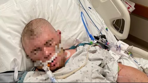 'Estaba gritando por ayuda': Joven es picado 20 mil veces por abejas mientras cortaba ramas de árboles