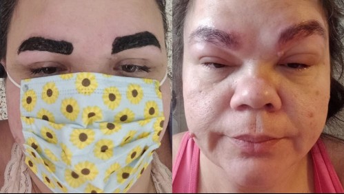 Se sometió a un tratamiento de belleza y el resultado la dejó aterrada: 'Sentí que me veía como Scar del Rey León'