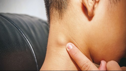 Estas son las claves que te ayudarán a reconocer si tienes los ganglios inflamados