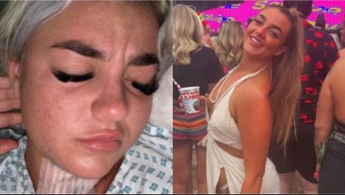 Dormía 14 horas al día, los doctores le dijeron que era floja, pero se trataba de una grave enfermedad