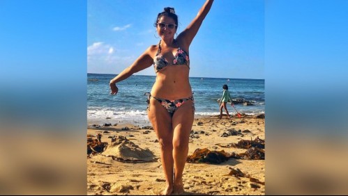 Han pasado 13 años de su operación: Esta es la cirugía que ayudó a Pamela Leiva a perder 65 kilos