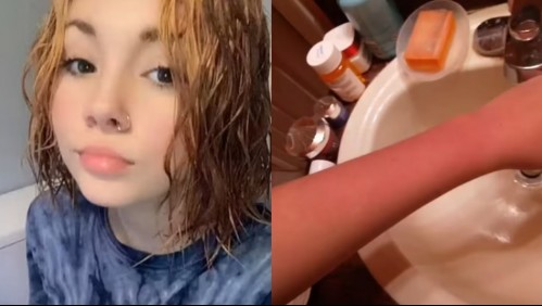 Llevó a su hija al dermatólogo por una extraña reacción en su piel y recibió una devastadora noticia