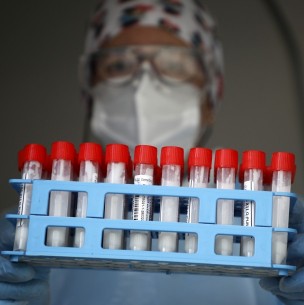 Balance coronavirus: Se reportan más de 4 mil casos nuevos y 29 fallecidos en las últimas 24 horas Balance coronavirus: Se reportan más de 4 mil casos nuevos y 29 fallecidos en las últimas 24 horas