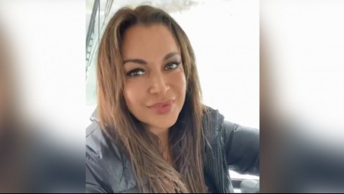 'Muchos años me molestaron': Esta es la complicación médica que sufrió Marlen Olivari al nacer y que la sigue afectando