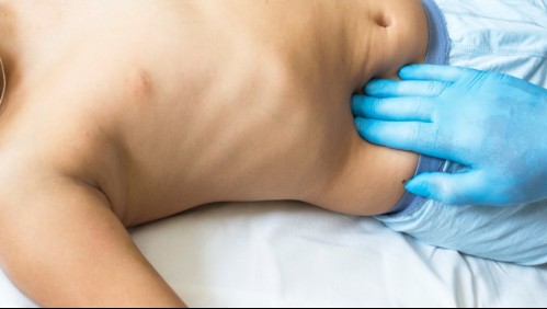 Este es el lado que duele: 6 síntomas que te ayudarán a reconocer si un niño tiene apendicitis